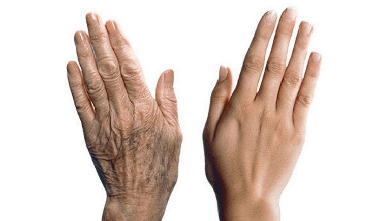 how to make your hands look younger