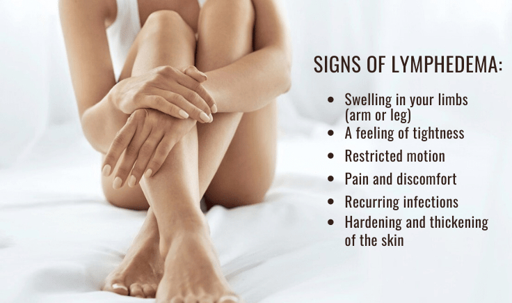 signs of lymphedema