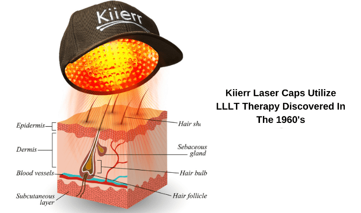 what makes level laser therapy cap the most effective and advanced hair regrowth treatment