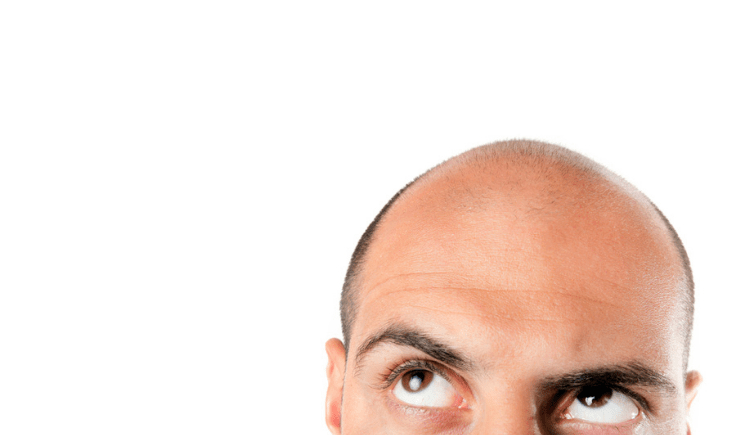 hair loss and alopecia areata