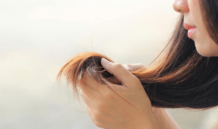 treating stress-related hair loss