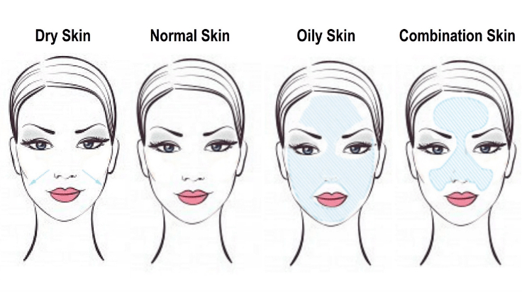 which skin types are best suited for radiofrequency facial treatment