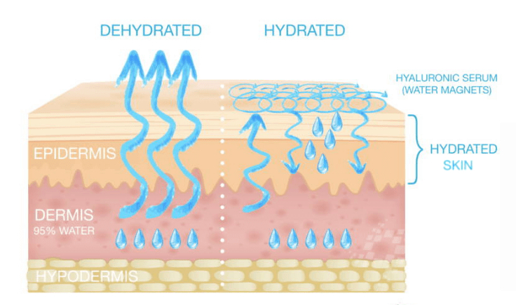 how do you detect dehydrated skin