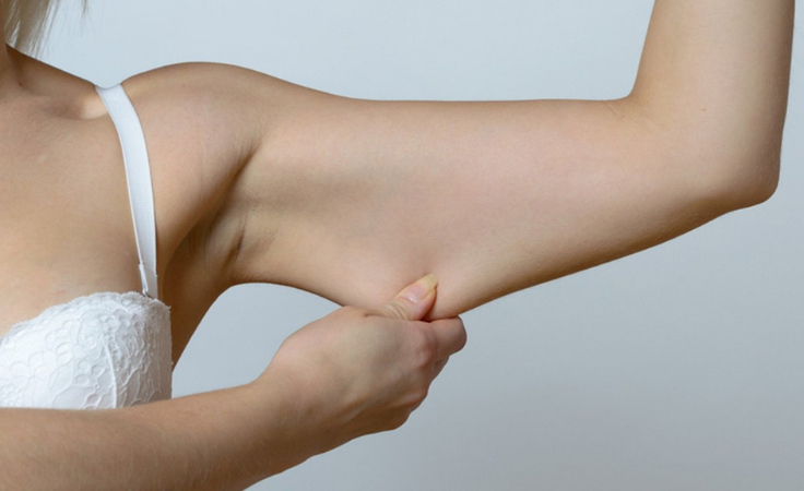 A biohacker shows sagging skin around arms